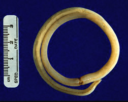 A. lumbricoides adult female worm