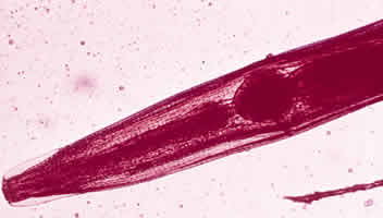 E. vermicularis adult, anterior end